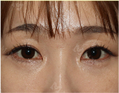눈 슬라이드 이미지