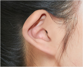 ear