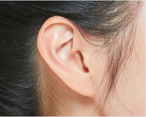 ear